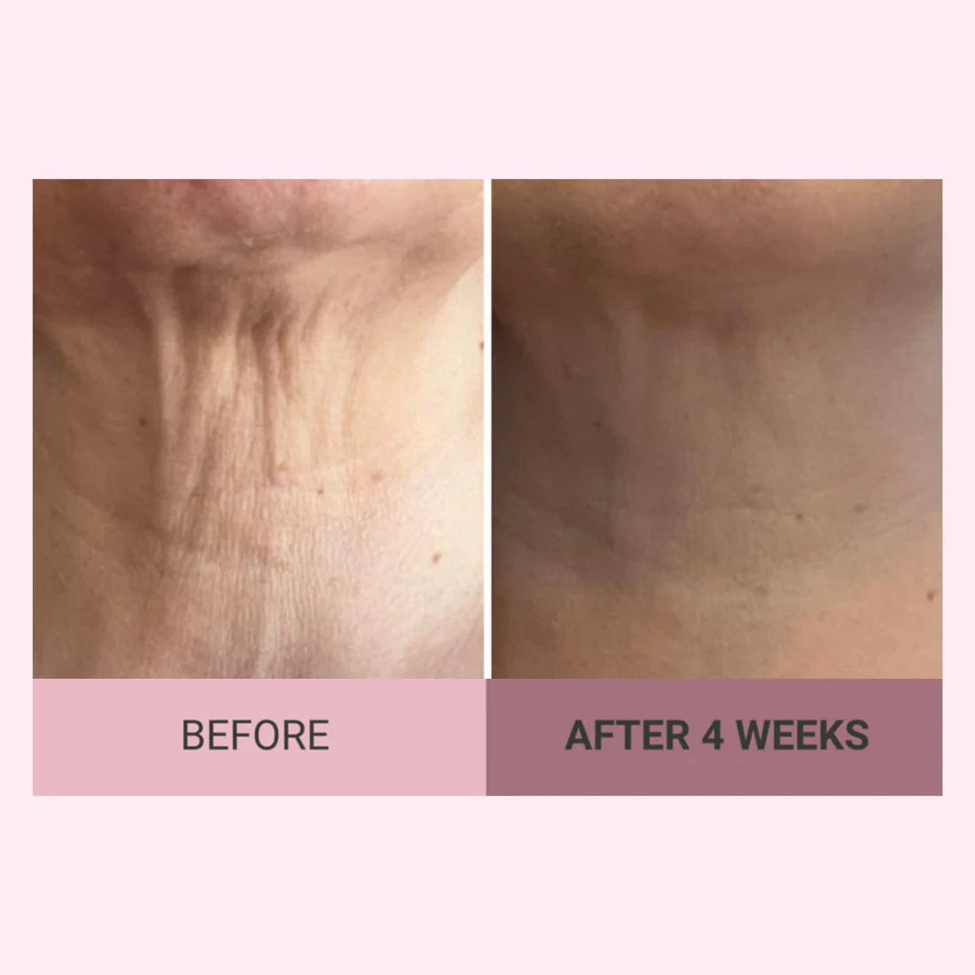 VELMEIRA™ Champagne Body Firming Creme by Dr. Terry Dubrow