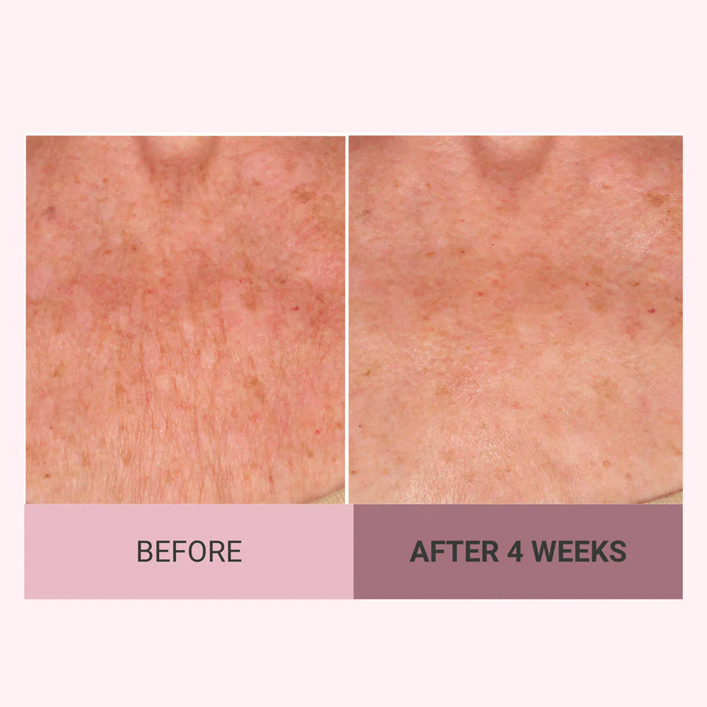 VELMEIRA™ Champagne Body Firming Creme by Dr. Terry Dubrow