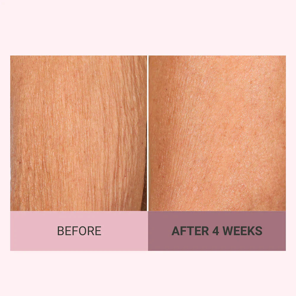 VELMEIRA™ Champagne Body Firming Creme by Dr. Terry Dubrow